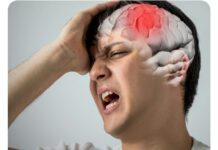 Waspada! Polusi Udara dapat Menjadi Pemicu Serangan Stroke
