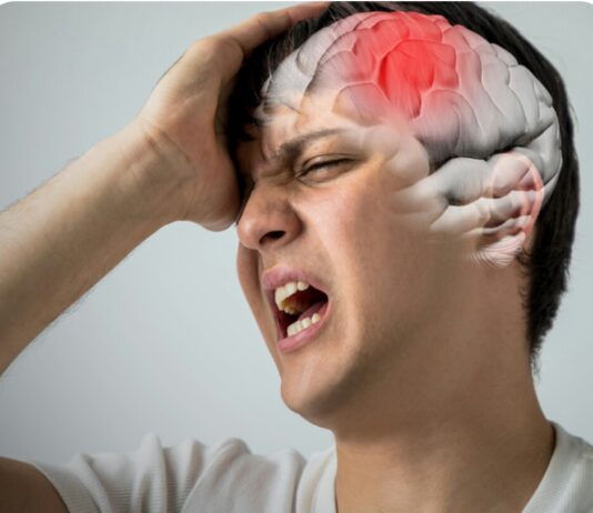 Tanda-tanda Stroke, Hati-hati Jika Sakit Kepala! Berikut Lima Gejala Stroke yang Harus Diwaspadai Lainnya