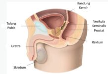 Penting Bagi Kaum Pria! Kenali Gejala dan Bahaya Kanker Prostat sebelum Terlambat