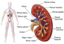 Cegah Gagal Ginjal pada Usia Muda, Simak Penjelasannya Medis Berikut