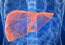 Waspada! Inilah 10 Makanan yang Mengancam Liver