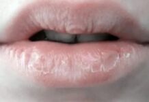Sebabkan Kulit Kering, Jangan Biasakan Menjilat Bibir!