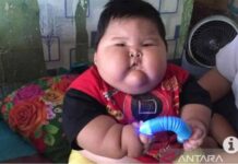Dokter Menyarankan Anak-anak Banyak Mengkonsumsi Protein Hewani, Mengapa?