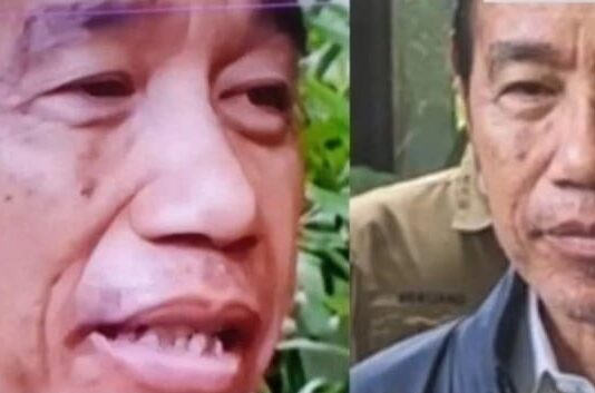 Dokter Bagikan Cara Cek Kulit Kering Saat Puasa, Ini Penjelasaannya